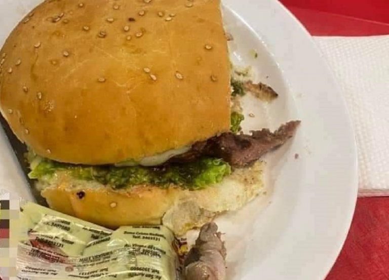 En Bolivie, une femme trouve un doigt humain dans son hamburger